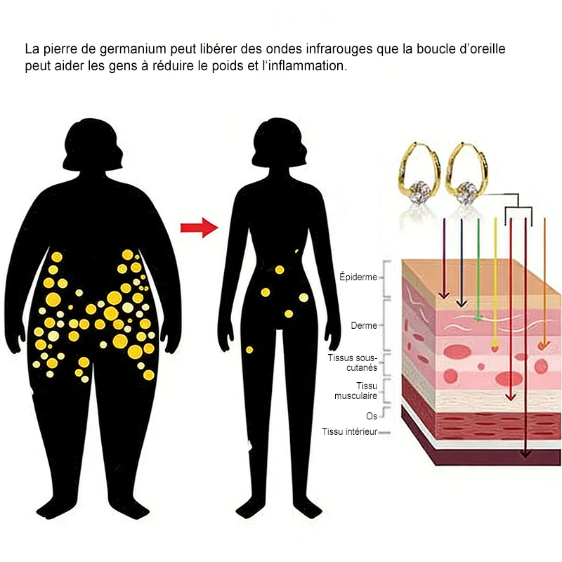 (🔥DERNIER JOUR DE PROMO - 70 % DE RÉDUCTION🔥) 🎉 CZTICLE® Boucles d'oreilles Lymphvity MagneTherapy au germanium - Image 9